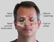 For Top-Class Sinus Treatment in Los Angeles – Come Here!